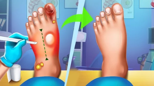 foot surgery doctor care offline doctor games MOD APK Android